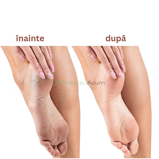 Pila electrica pentru curatarea si ingrijirea calcaielor BeautyFeet